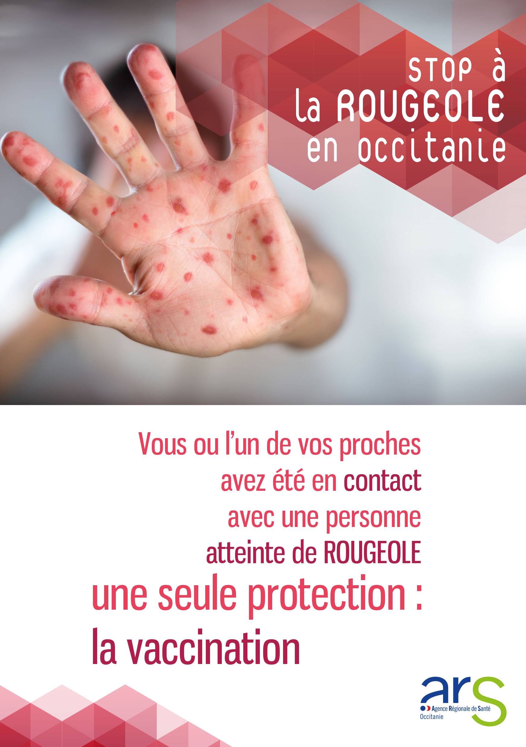 Epidémie de rougeole dans les Pyrénées Orientales